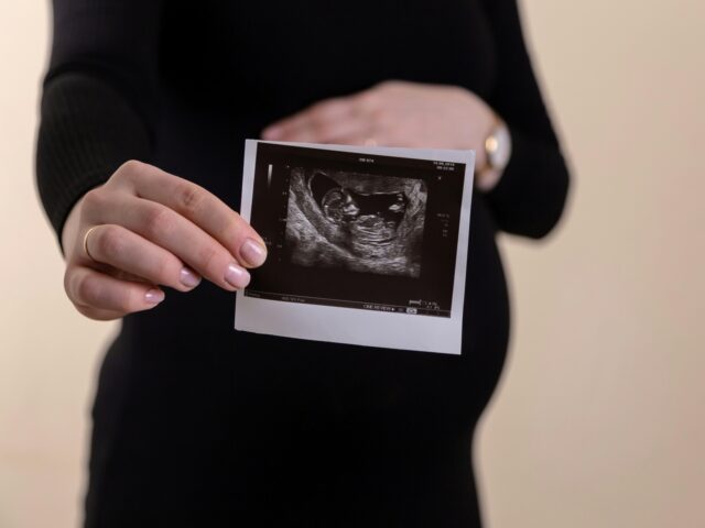 https://media.breitbart.com/media/2025/01/fetus-640x480.jpg